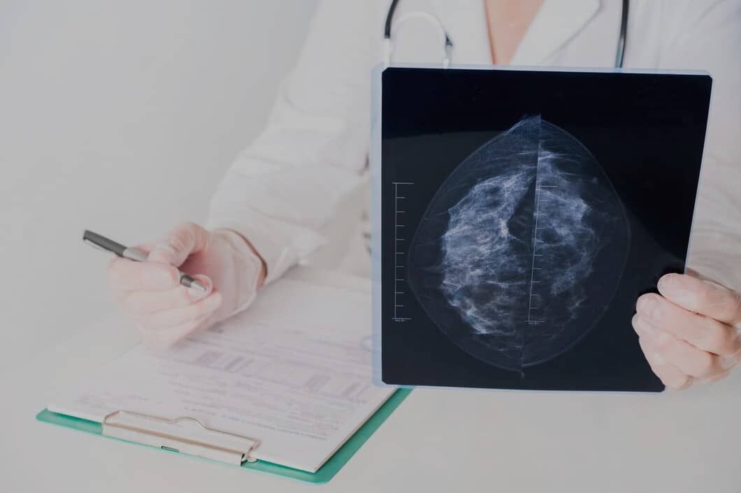 Médico avaliando mamografia de paciente